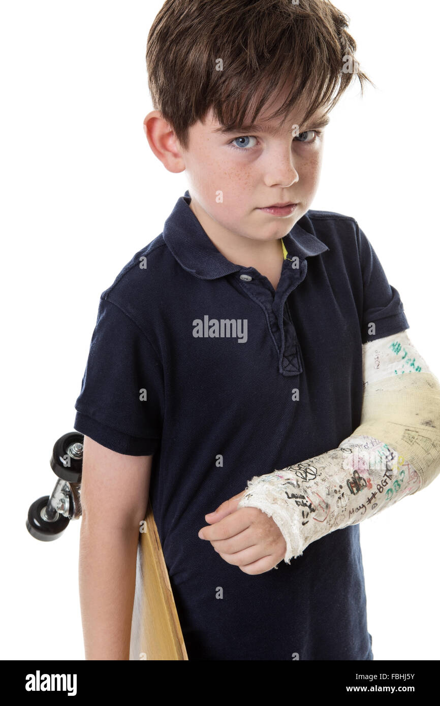 Young boy is unable to use his skateboard because he has broken his arm