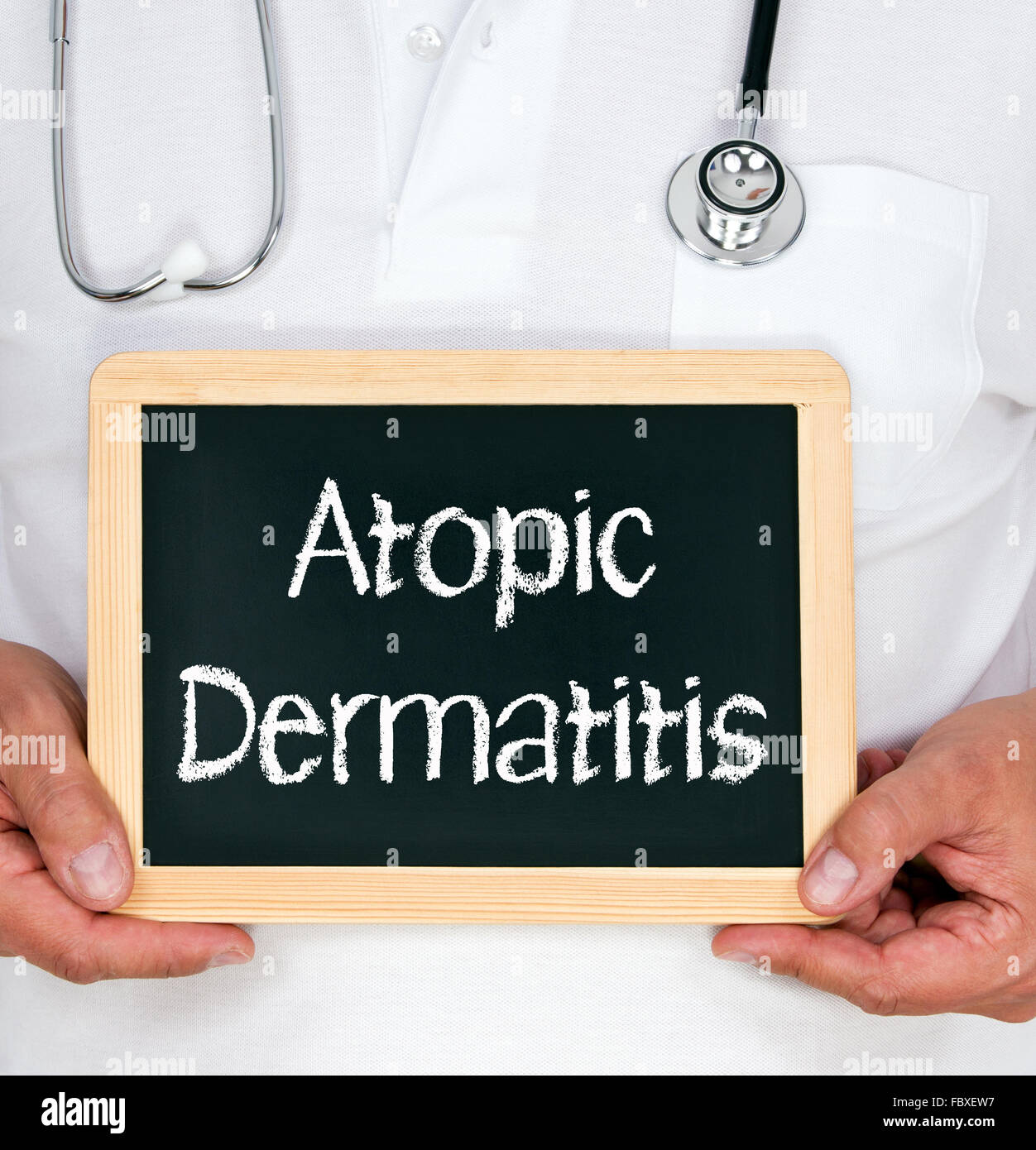 Atopic Dermatitis Stock Photo