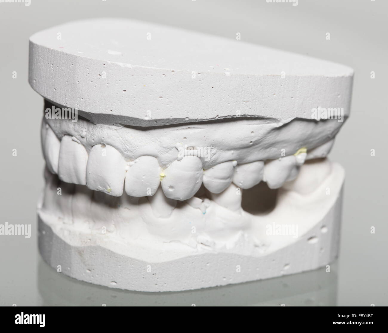 Dental gypsum model mould of teeth in plaster Stock Photo - Alamy