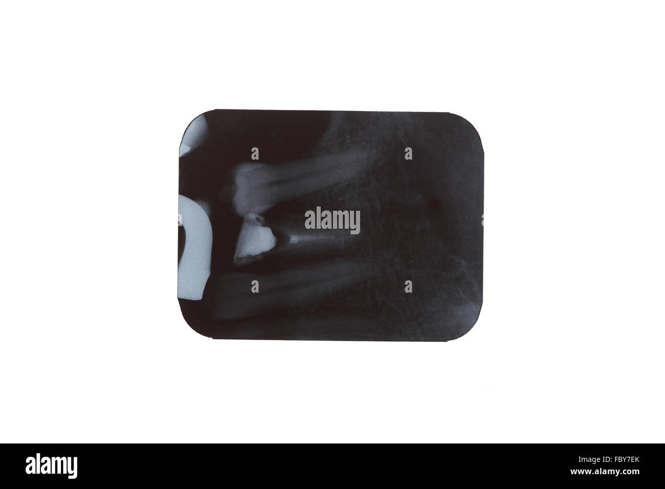 dental xray film detail Stock Photo Alamy