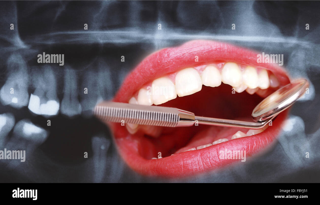 Closeup human teeth and dental mirror on xray scan background Stock