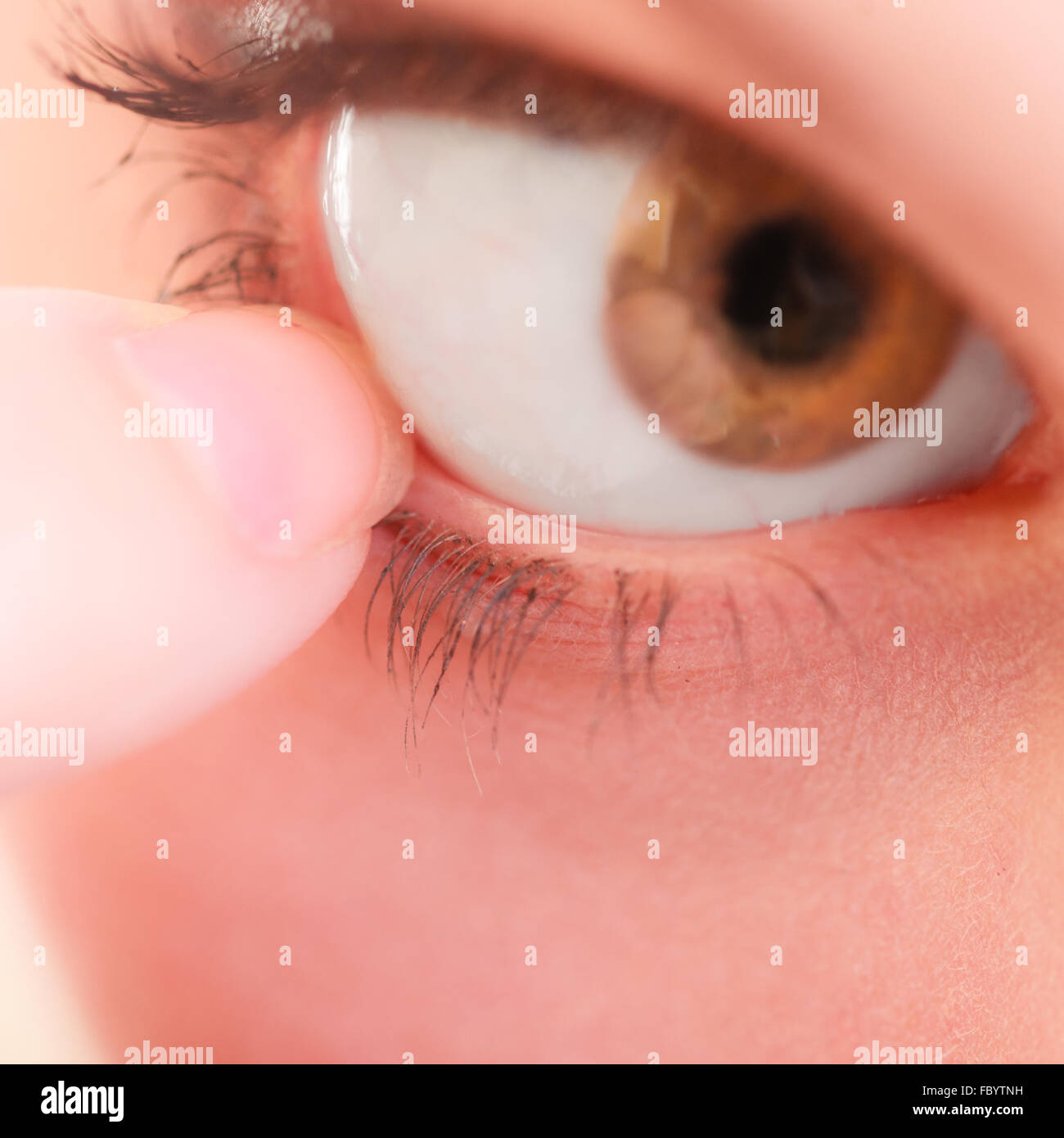 part-of-face-human-eye-pain-foreign-body-stock-photo-alamy