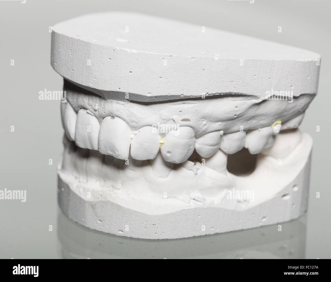 Colorful dental braces or retainer on teeth mold, clay human gums model  Stock Photo - Alamy