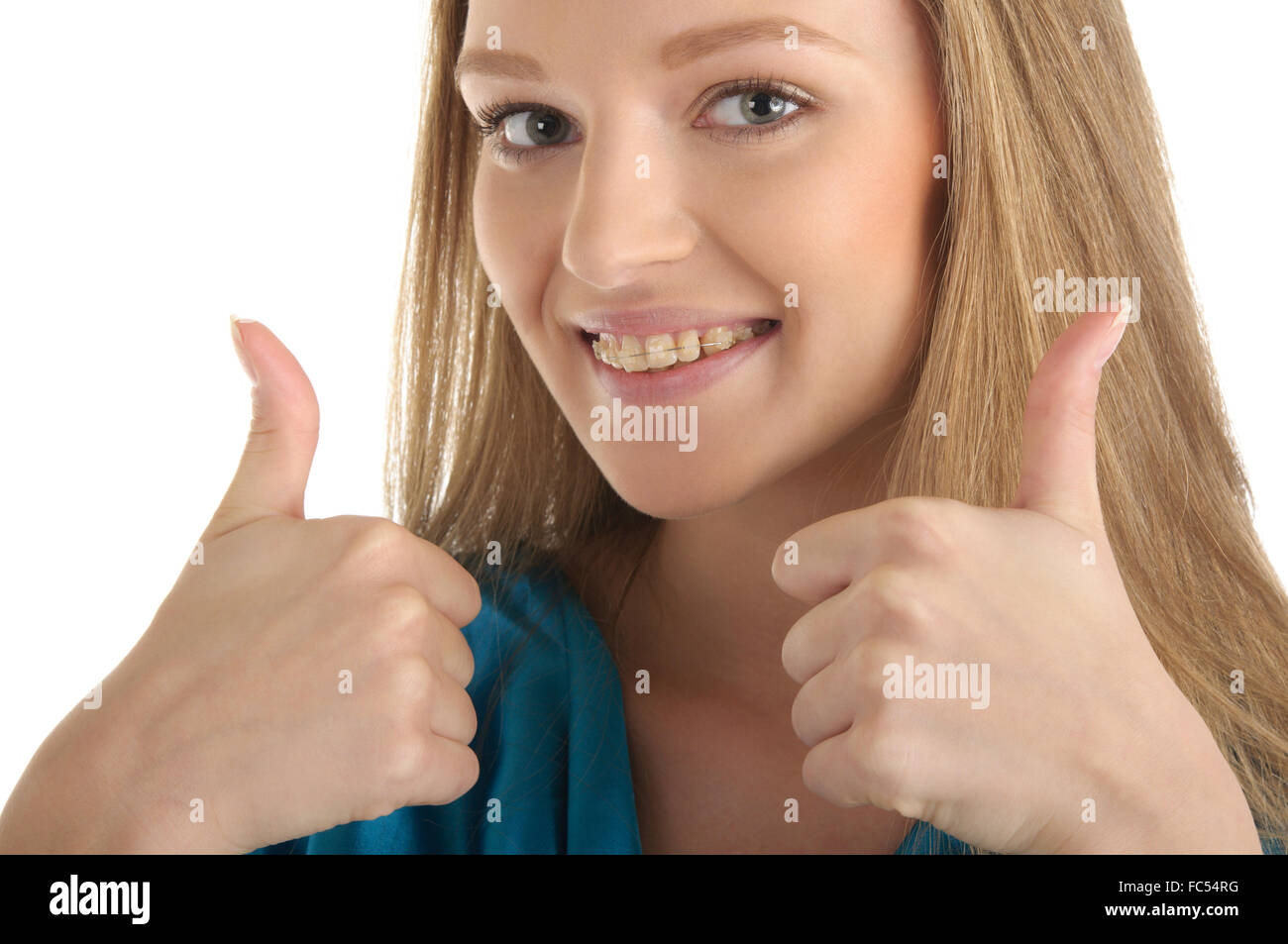 Woman with brackets on teeth Stock Photo