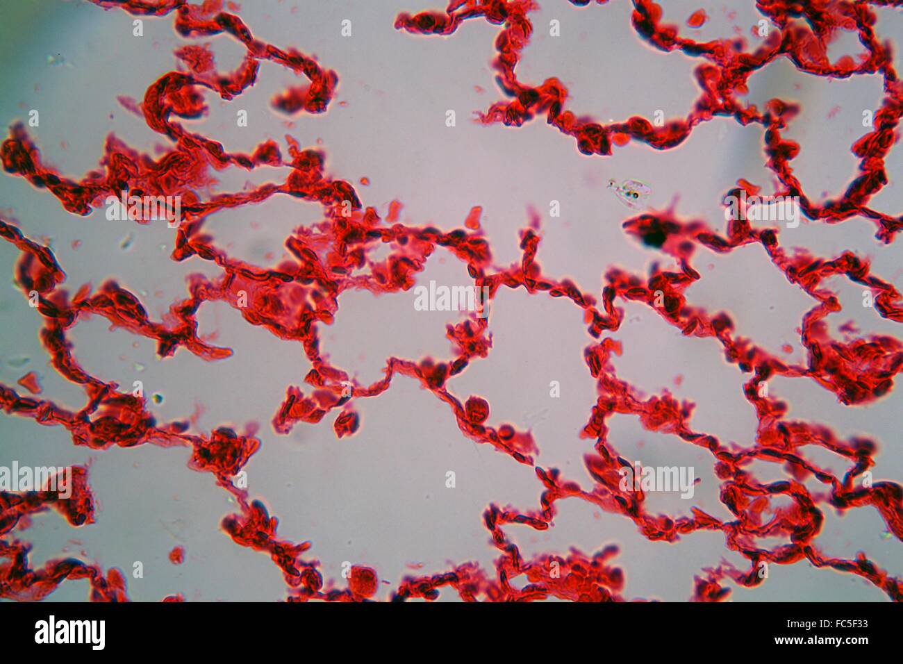 Lung cells under the microscope Stock Photo