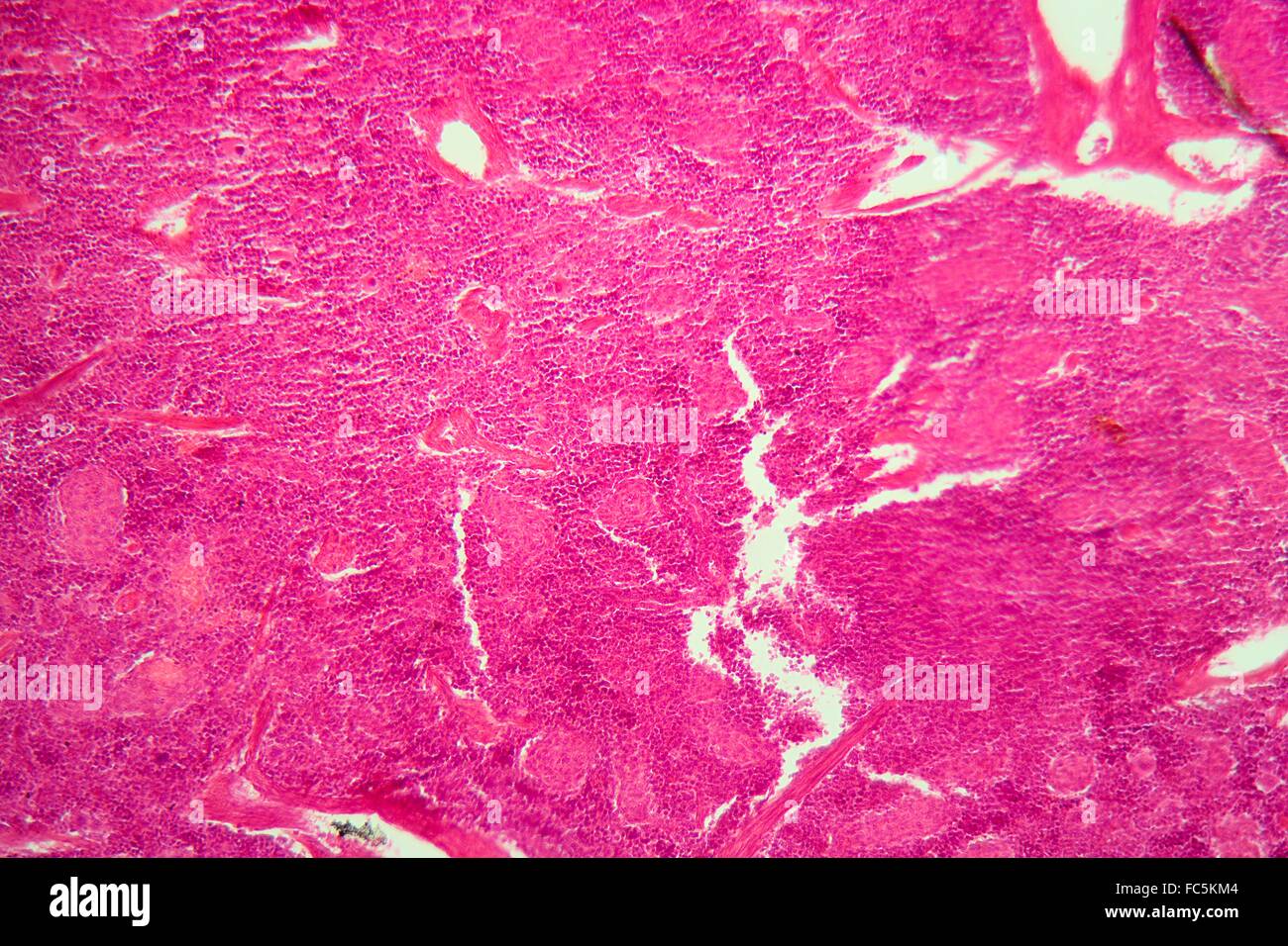 Pancreas tissue under the microscope. Stock Photo