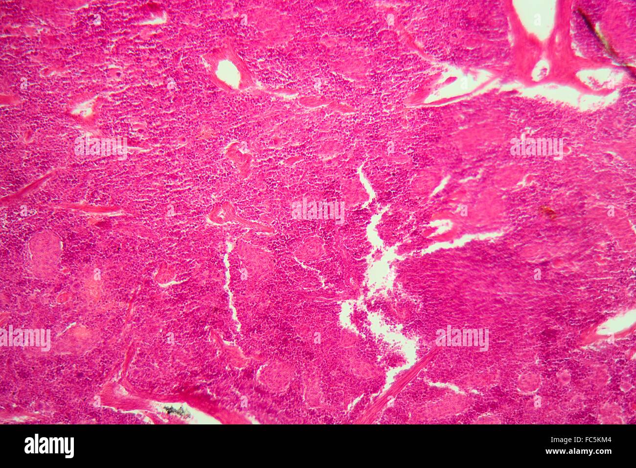 Pancreas tissue under the microscope Stock Photo - Alamy