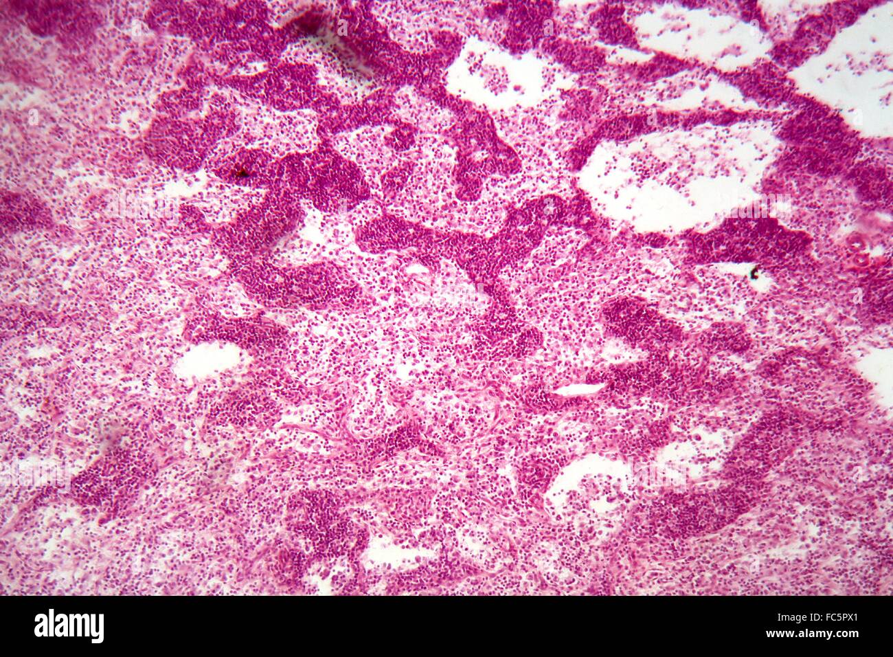 Lymph node under the microscope. Stock Photo