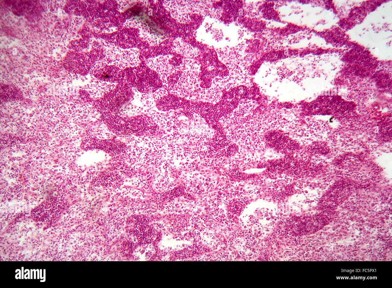 Lymph node under the microscope Stock Photo - Alamy