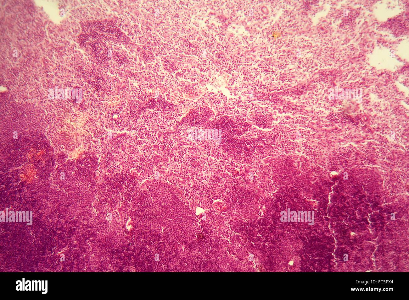 Lymph node under the microscope. Stock Photo