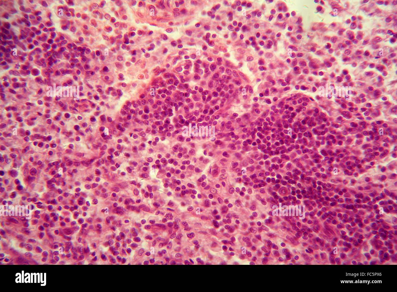 Lymph node under the microscope. Stock Photo