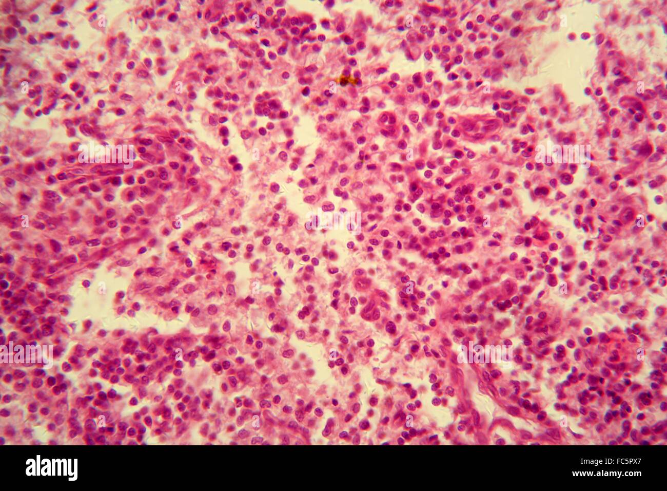 Lymph node under the microscope Stock Photo - Alamy