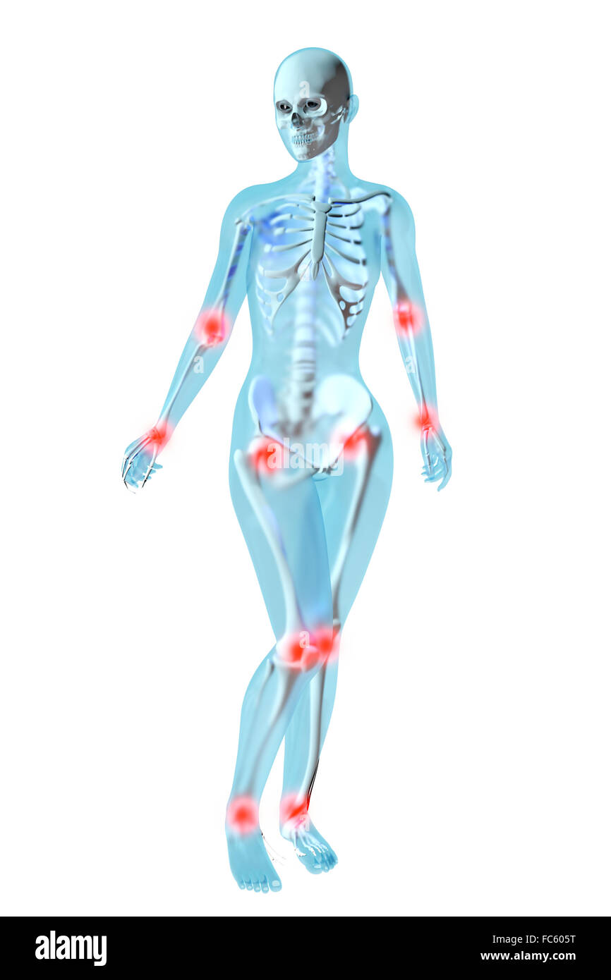 Female Anatomy Joint ache Stock Photo Alamy