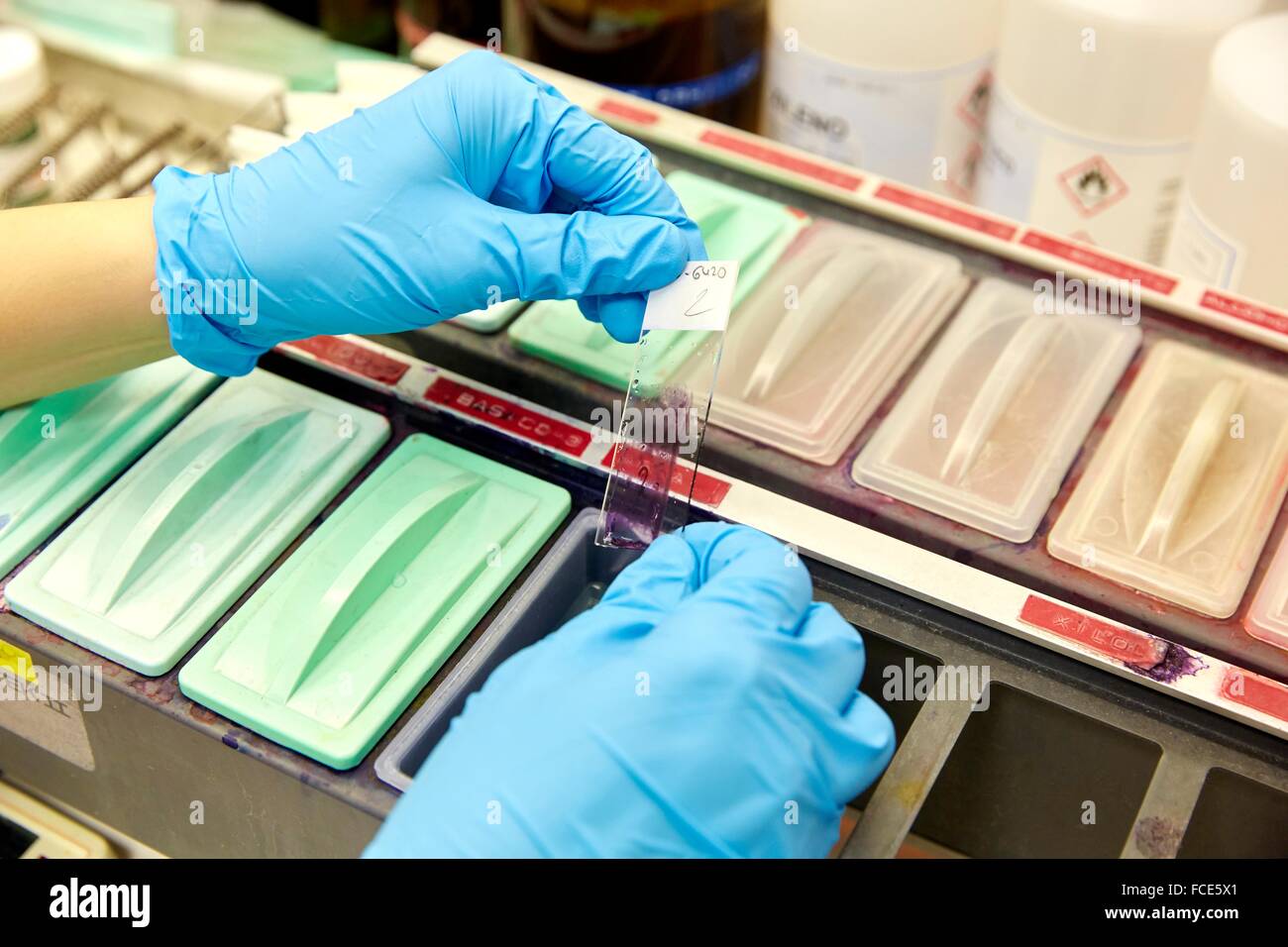 Cytology, Anatomic Pathology, Hospital Donostia, San Sebastian, Gipuzkoa, Basque Country, Spain Stock Photo