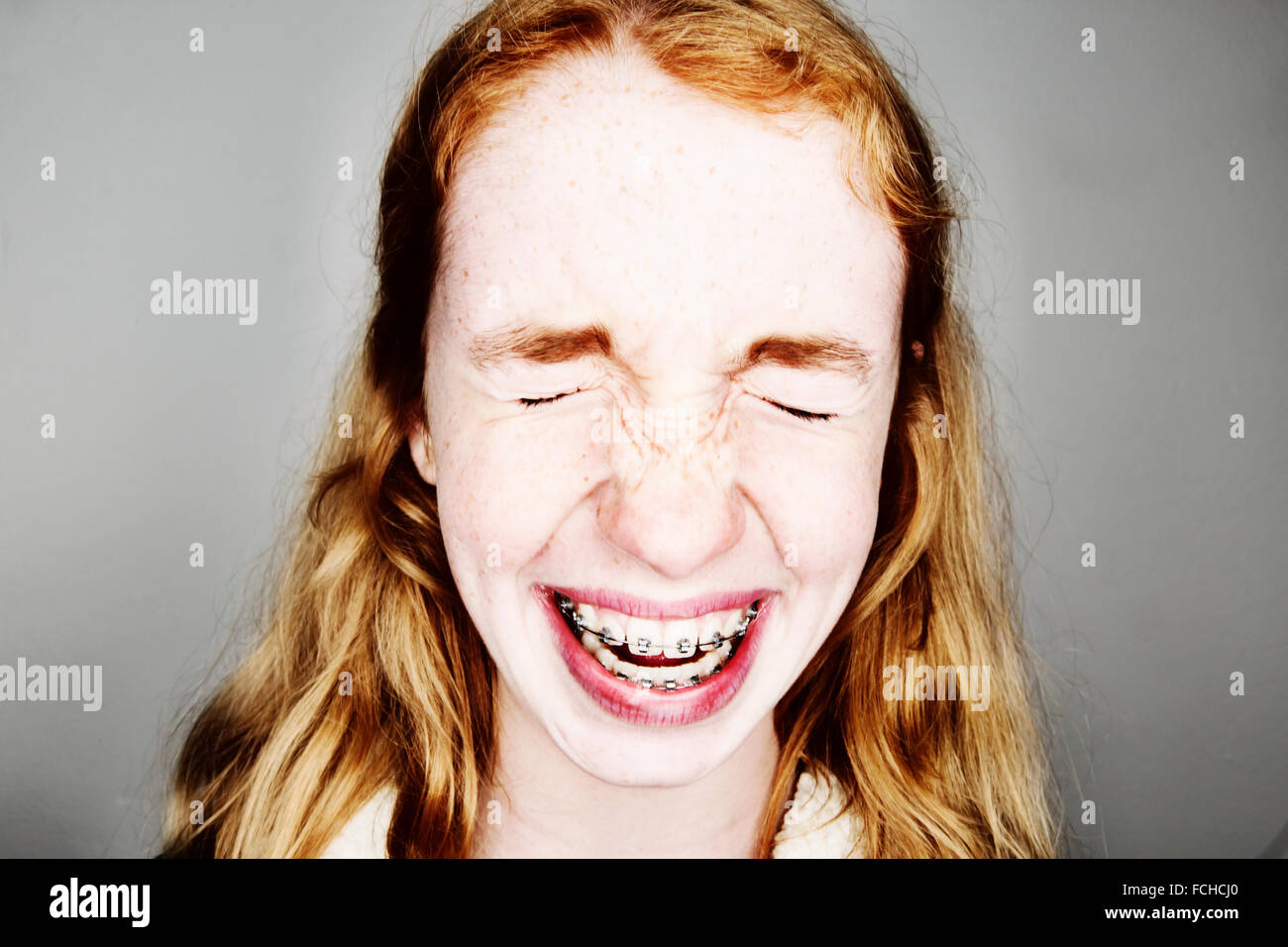 Portrait of laughing girl braces Stock Photo Alamy