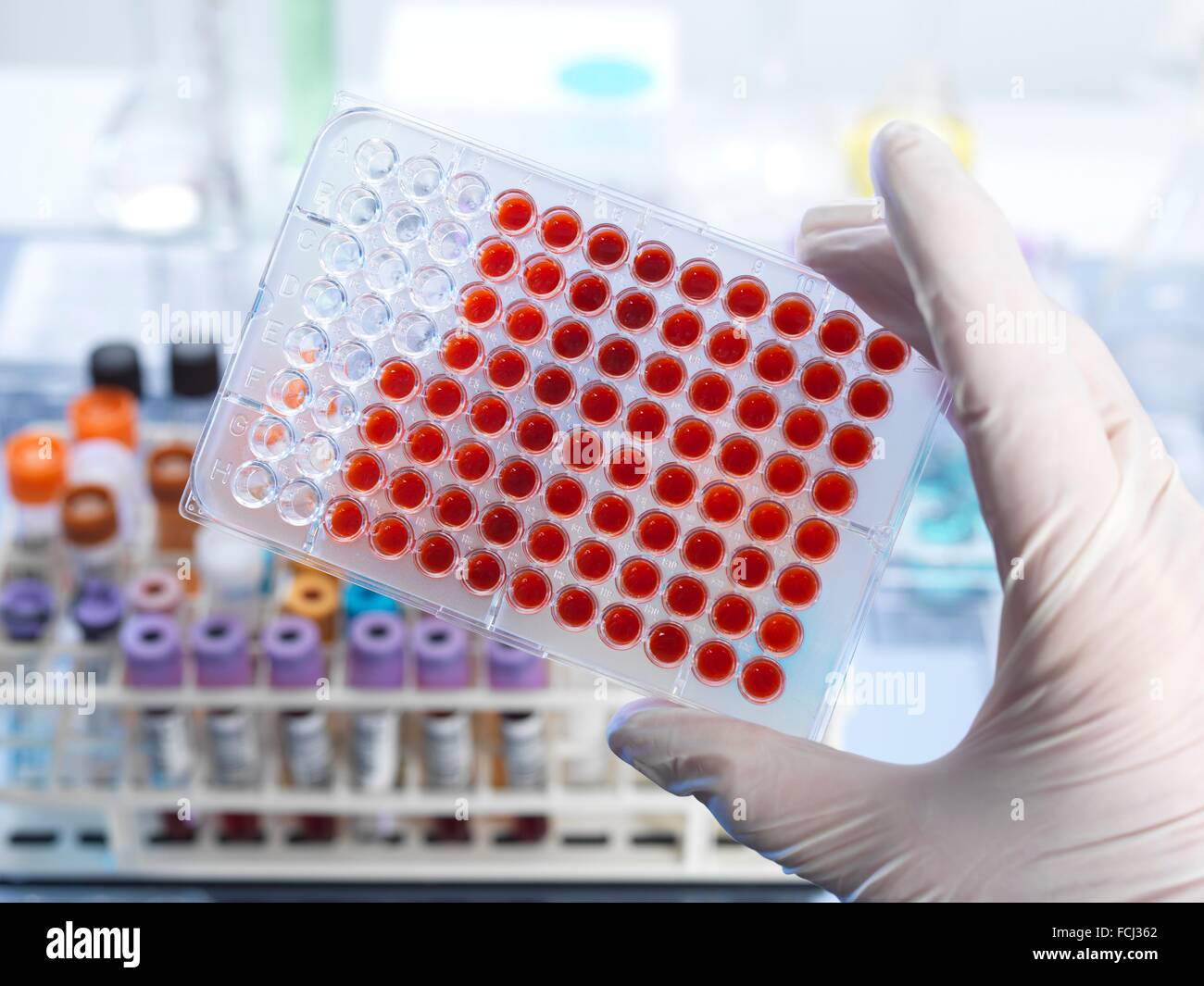 Blood Group Test Stock Photos & Blood Group Test Stock Images Alamy