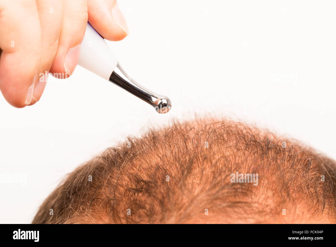 Man with a premature and incipient baldness Stock Photo