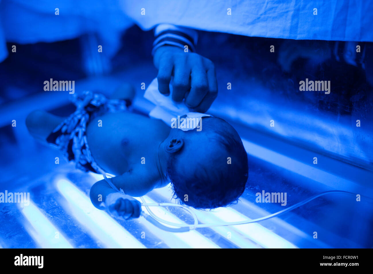 Dhaka, Bangladesh. 24th January, 2016. A jaundice child taking