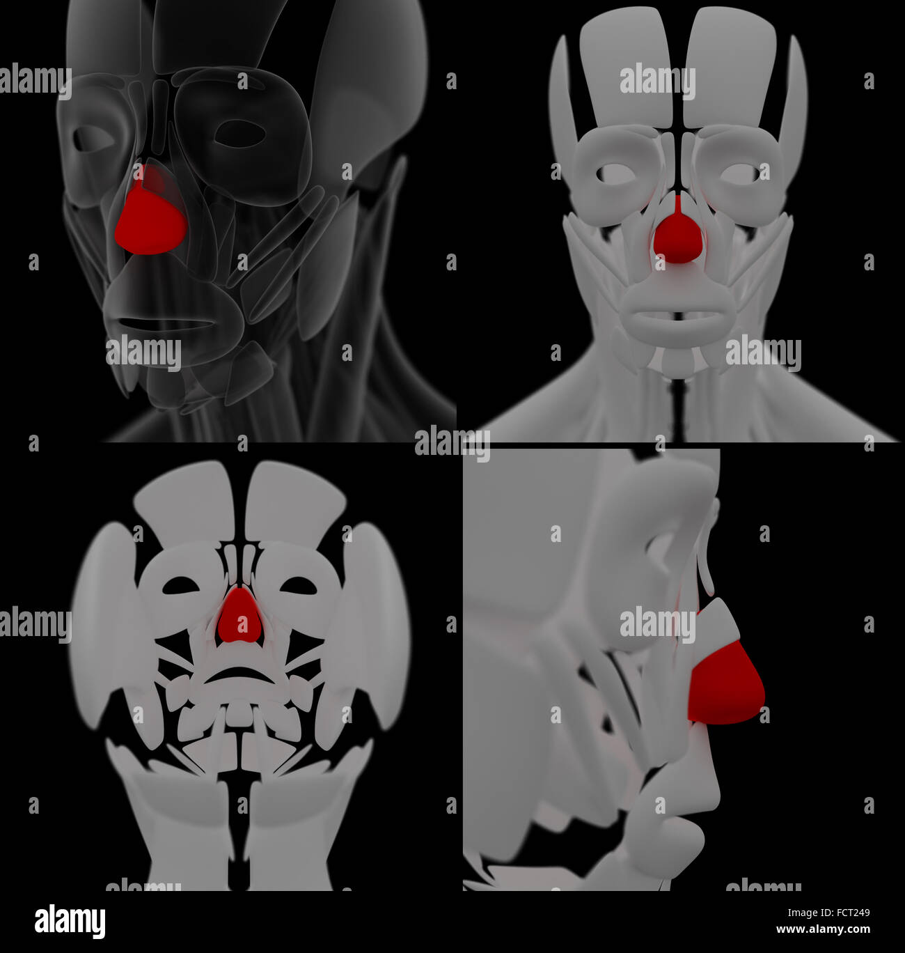 medical illustration of the Dilator Naris Stock Photo Alamy