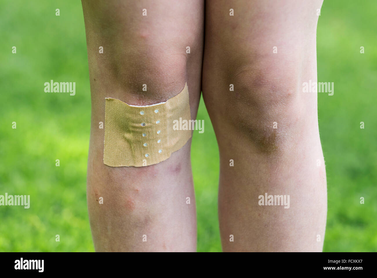 Bruise and leg hires stock photography and images Alamy