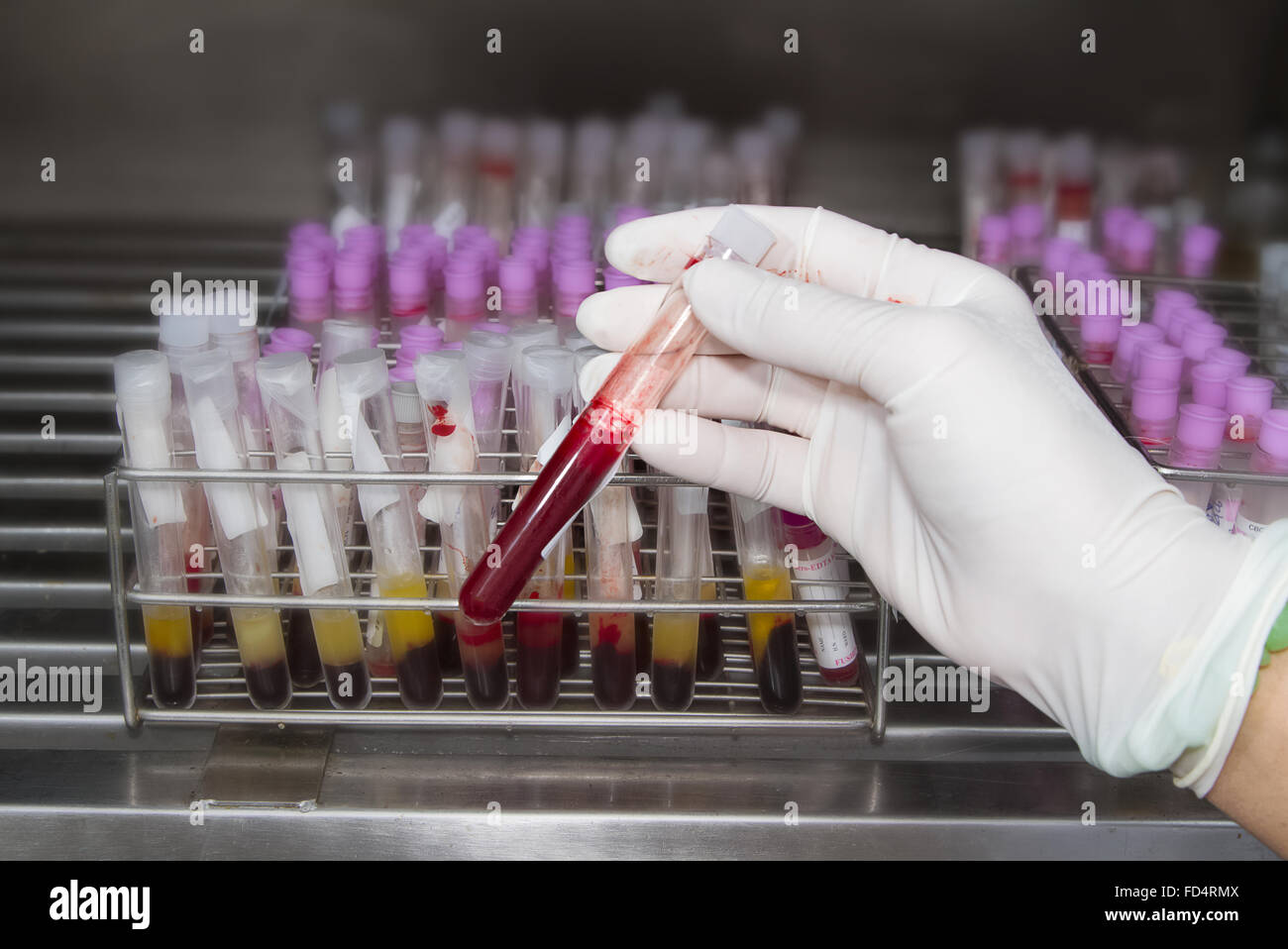 lab technician holding blood tube test in blood bank background blood