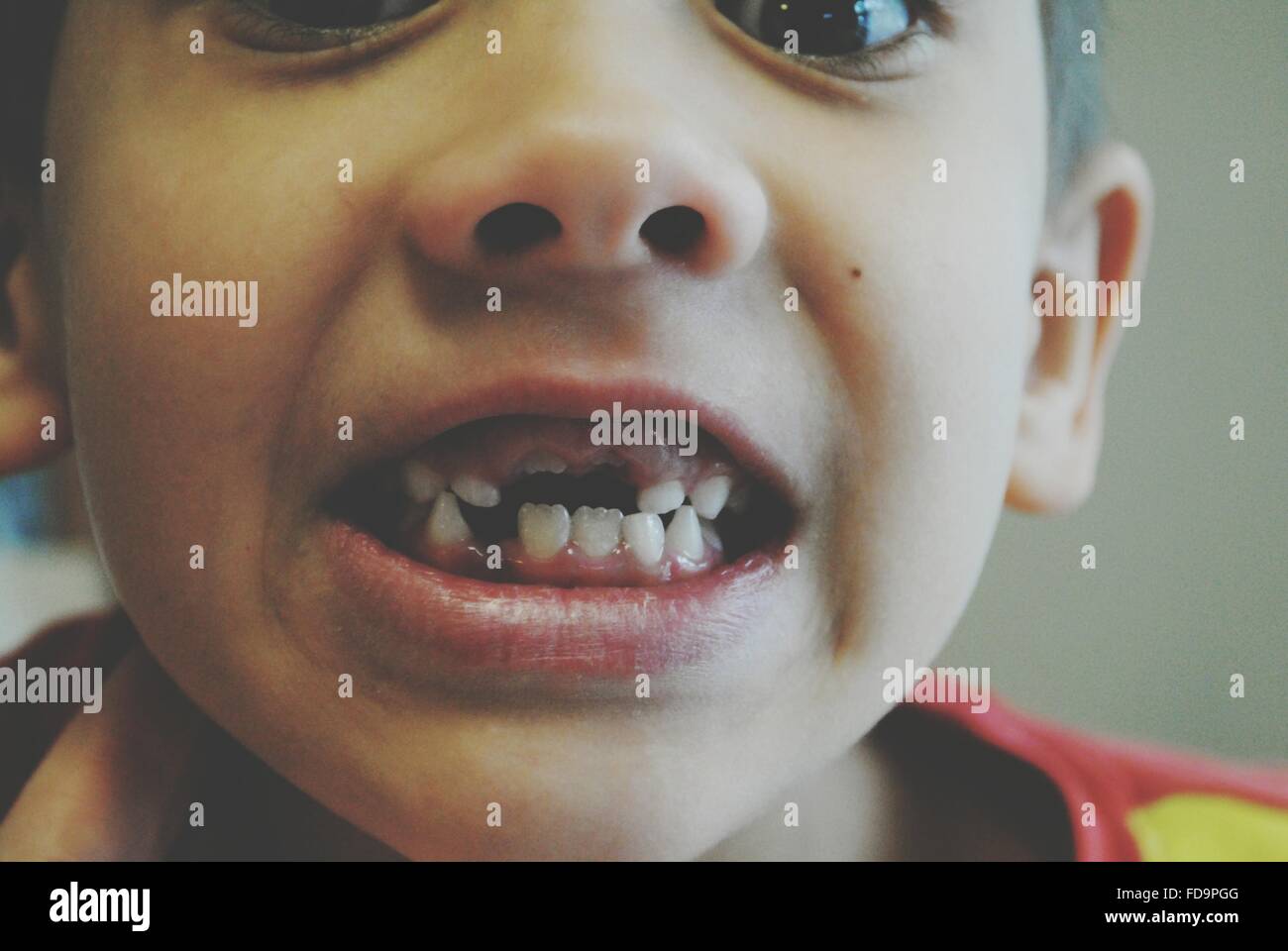 Close-Up Of Boy With Missing Tooth Stock Photo