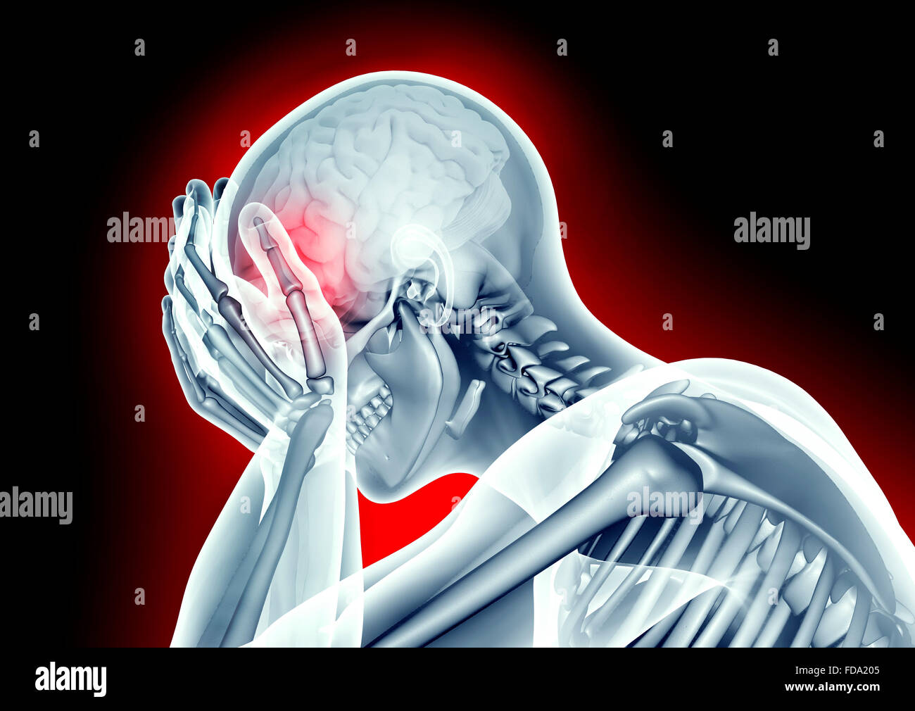 xray image human head with headache pain Stock Photo Alamy