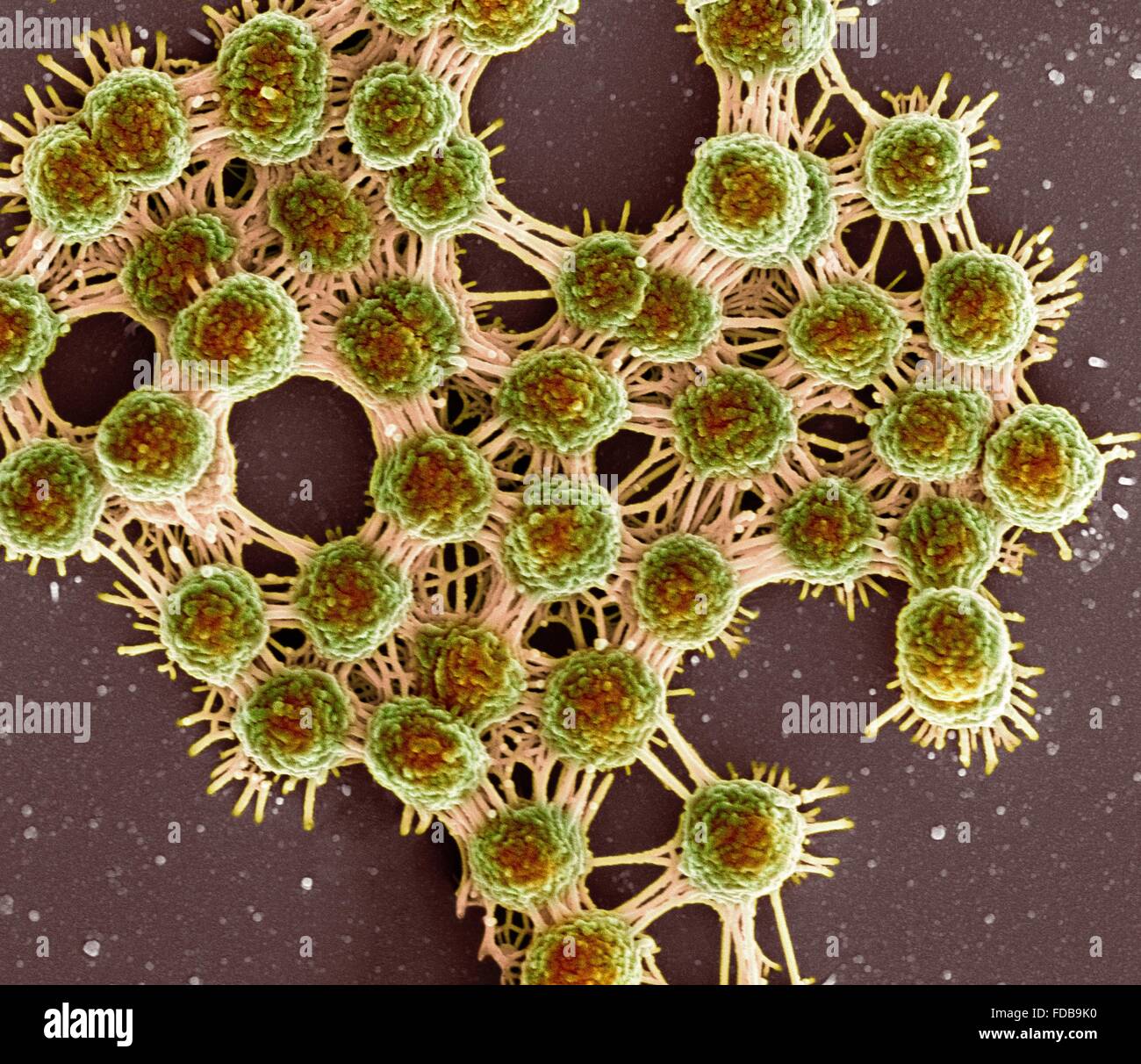 Saliva and bacteria. Coloured scanning electron micrograph (SEM) of a bacterial biofilm from saliva. This cluster of round bacteria (cocci) are linked together by stands of eDNA (extracellular deoxyribonucleic acid). The eDNA helps the biofilm to adhere to oral surfaces and contributes to antimicrobial resistance. Stock Photo