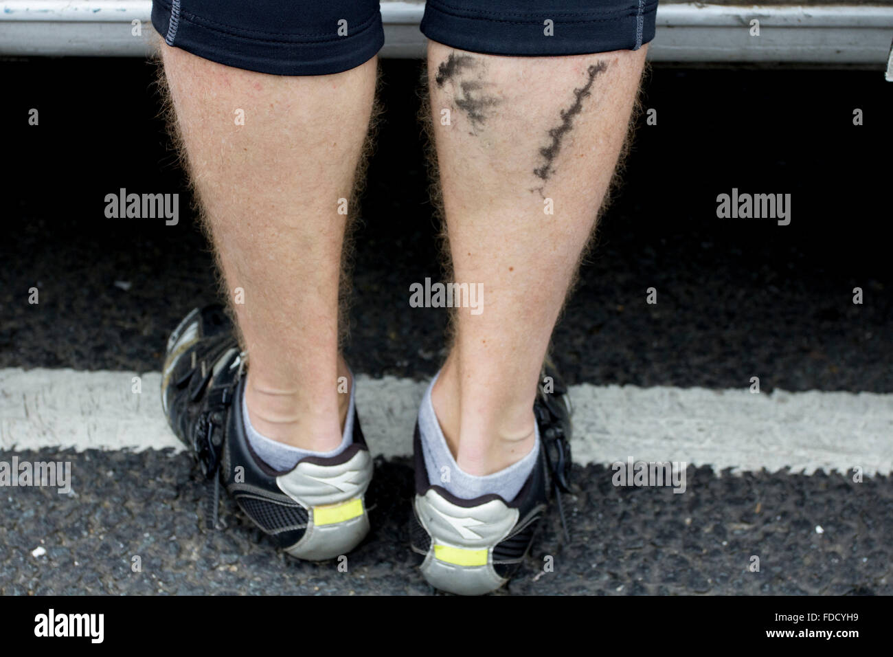 A cyclist with an oily mark on his leg from a bike cog Stock Photo