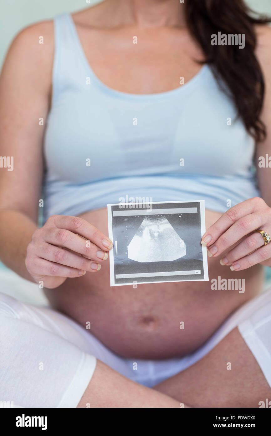 pregnant-woman-showing-ultrasound-scan-stock-photo-alamy