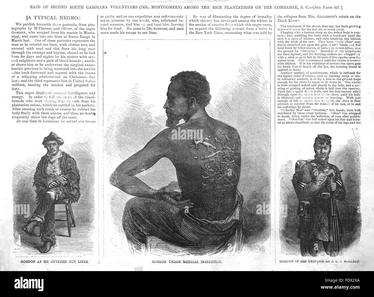 GORDON  Slave who escaped to a Union Army camp at Baton Rouge during the American Civil War in 1863. The centre image in Harper's Weekly for 4 July 1863 derives from a photograph by McPherson and Oliver in Matthew Brady's studio. Stock Photo
