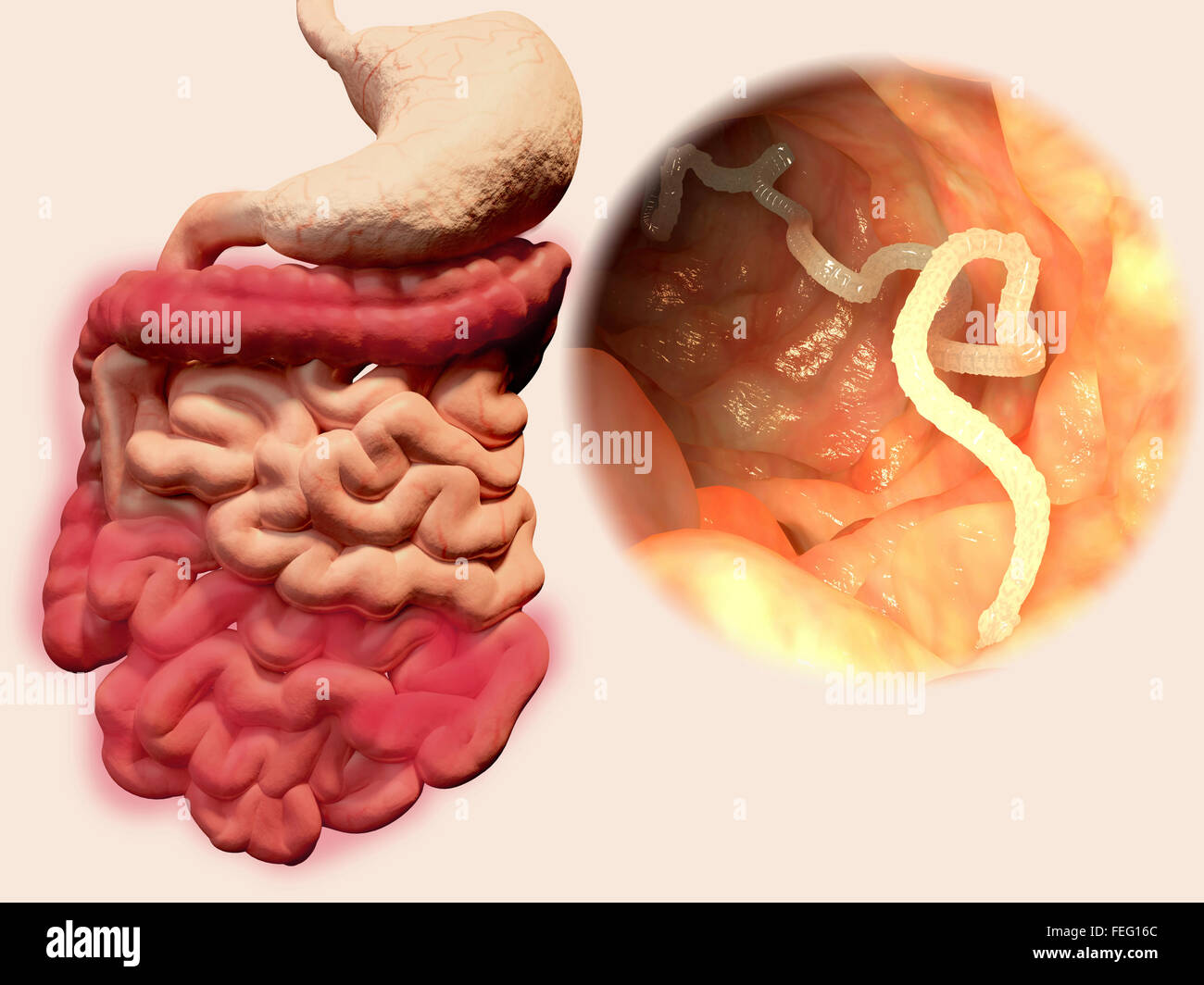 Illustration of a tapeworm in a human intestine. Tapeworms (Taenia sp.) are parasites that inhabit the human gut. They anchor Stock Photo