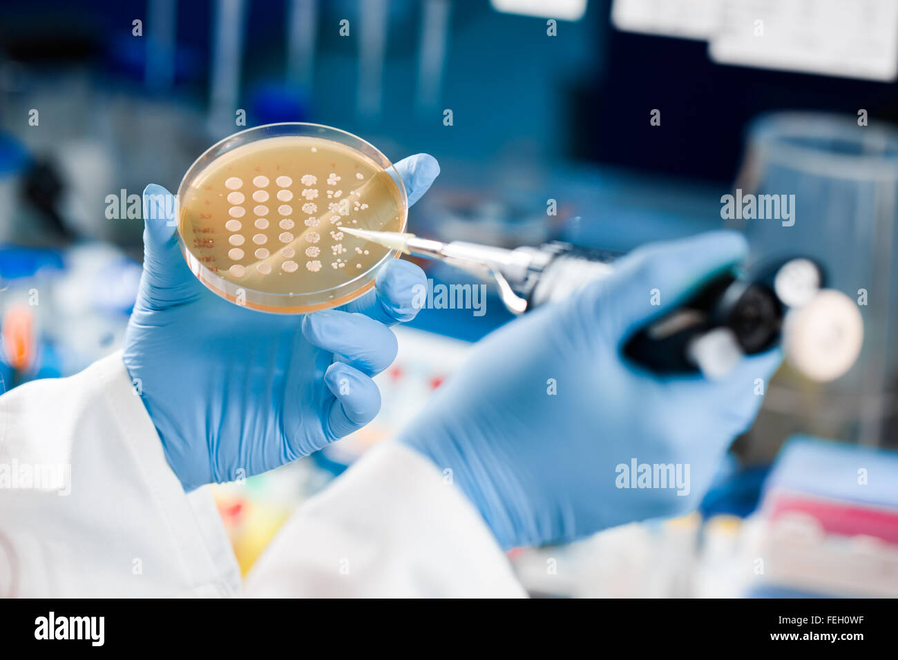 Two hands seen doing yeast spot assay or inoculation Stock Photo Alamy