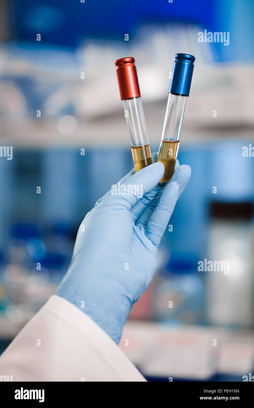 Choice, victory, scientist holding red and blue vials or test tubes Stock Photo