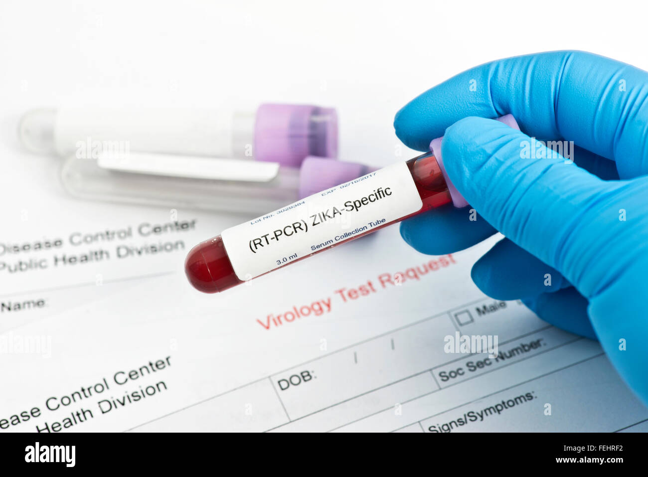 Zika virus blood analysis collection tube with virology lab request ...