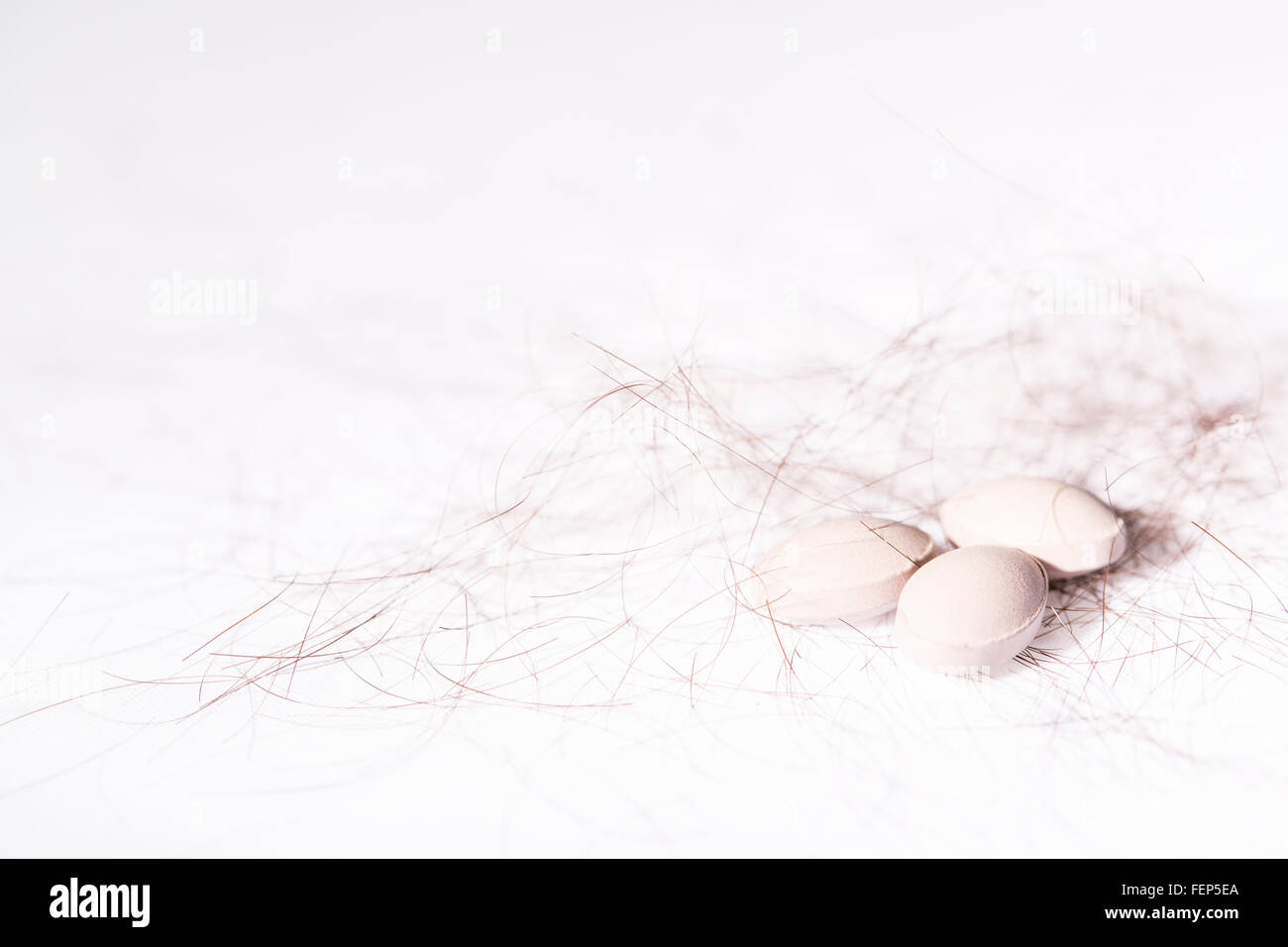 Hair loss problem Stock Photo Alamy