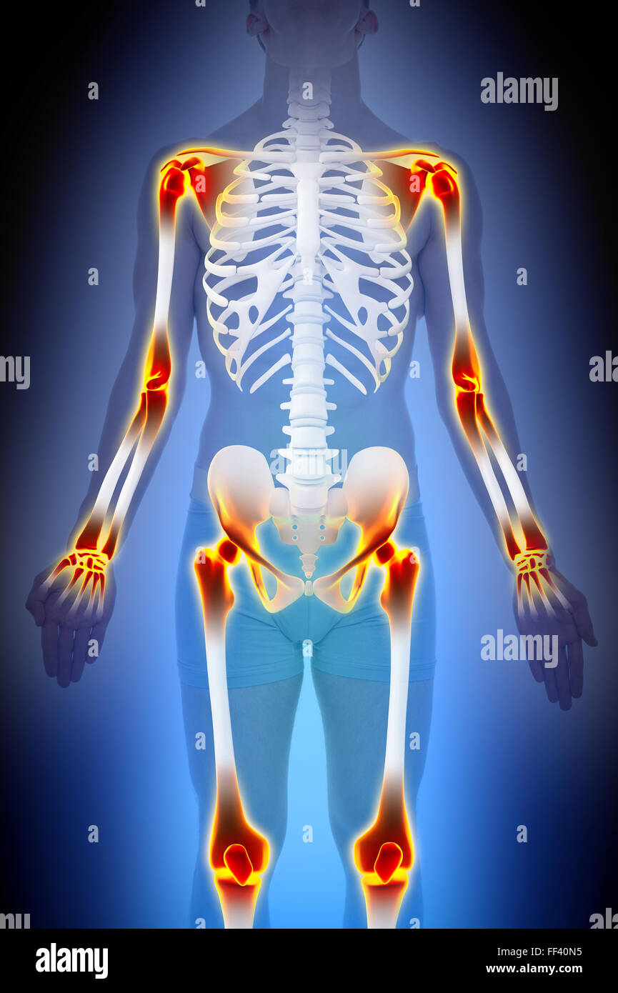 Arthritis Joints Pain Anatomy Male concept Stock Photo