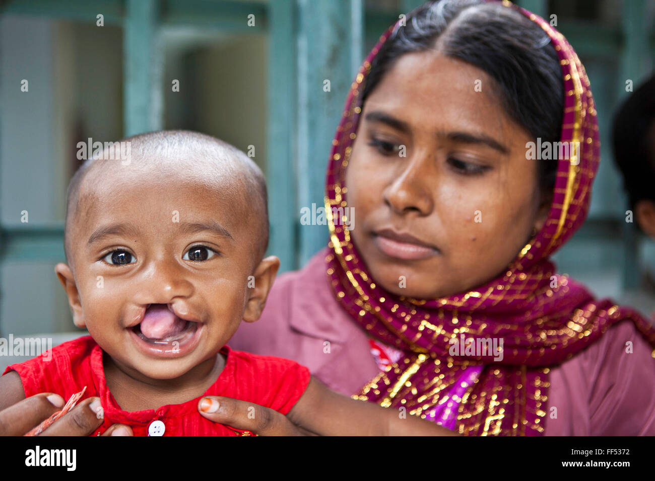 Amina and her 10 month old son, Asirul, wait to see a doctor for cleft palate surgery at the IFB Chuandanga Hospital in the western region of Bangladesh. Impact Foundation Bangladesh (IFB) provide care, support and treatment to people with disabilities in Bangladesh. Stock Photo