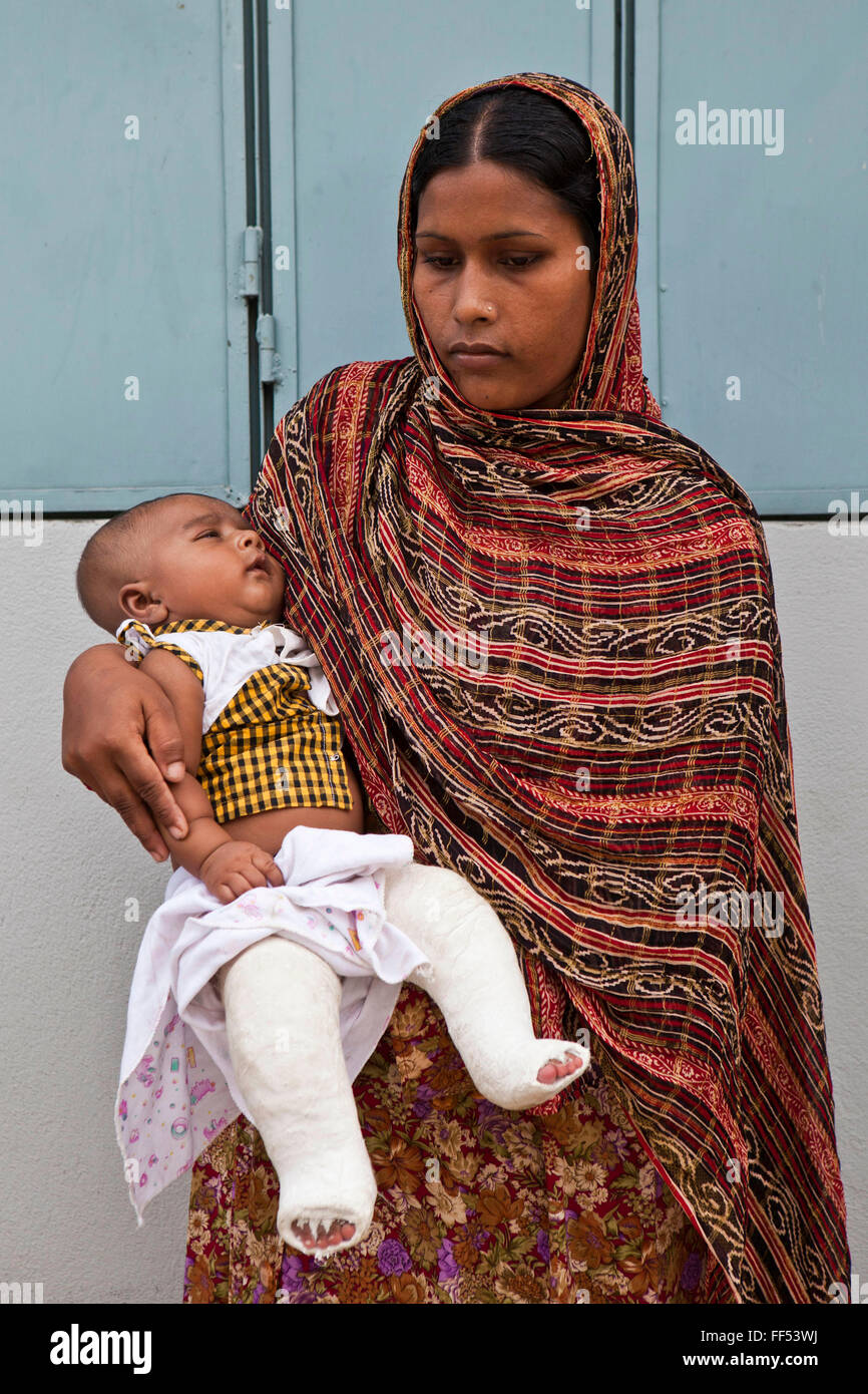 Talipes High Resolution Stock Photography And Images Alamy Talipes High Resolution Stock Photography And Images Alamy