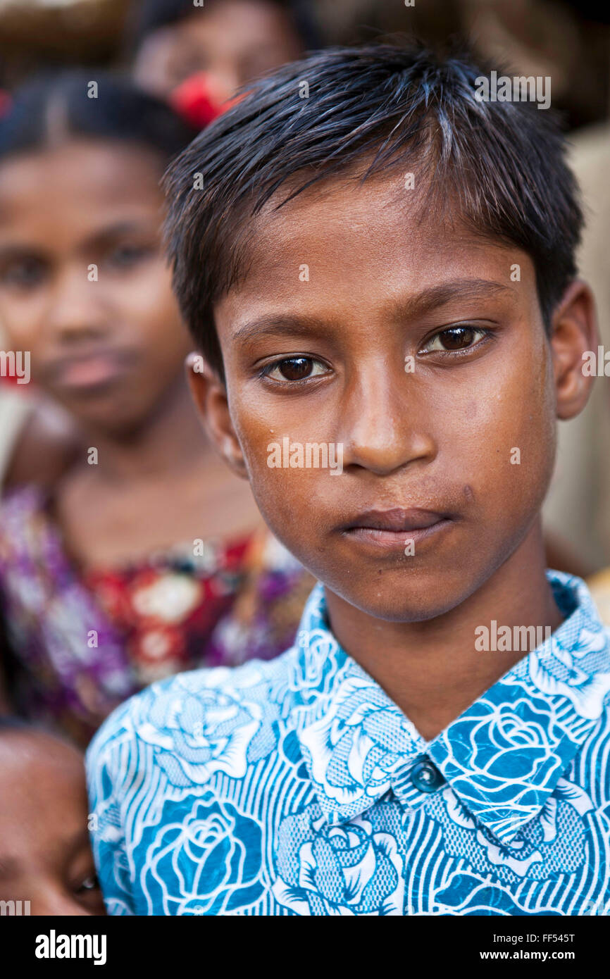 Abdul, aged 12, received Cleft Palate Surgery in 2002 at the IFB Chuandanga Hospital in the western region of Bangladesh.  Impact Foundation Bangladesh (IFB) provide care, support and treatment to people with disabilities in Bangladesh. Stock Photo