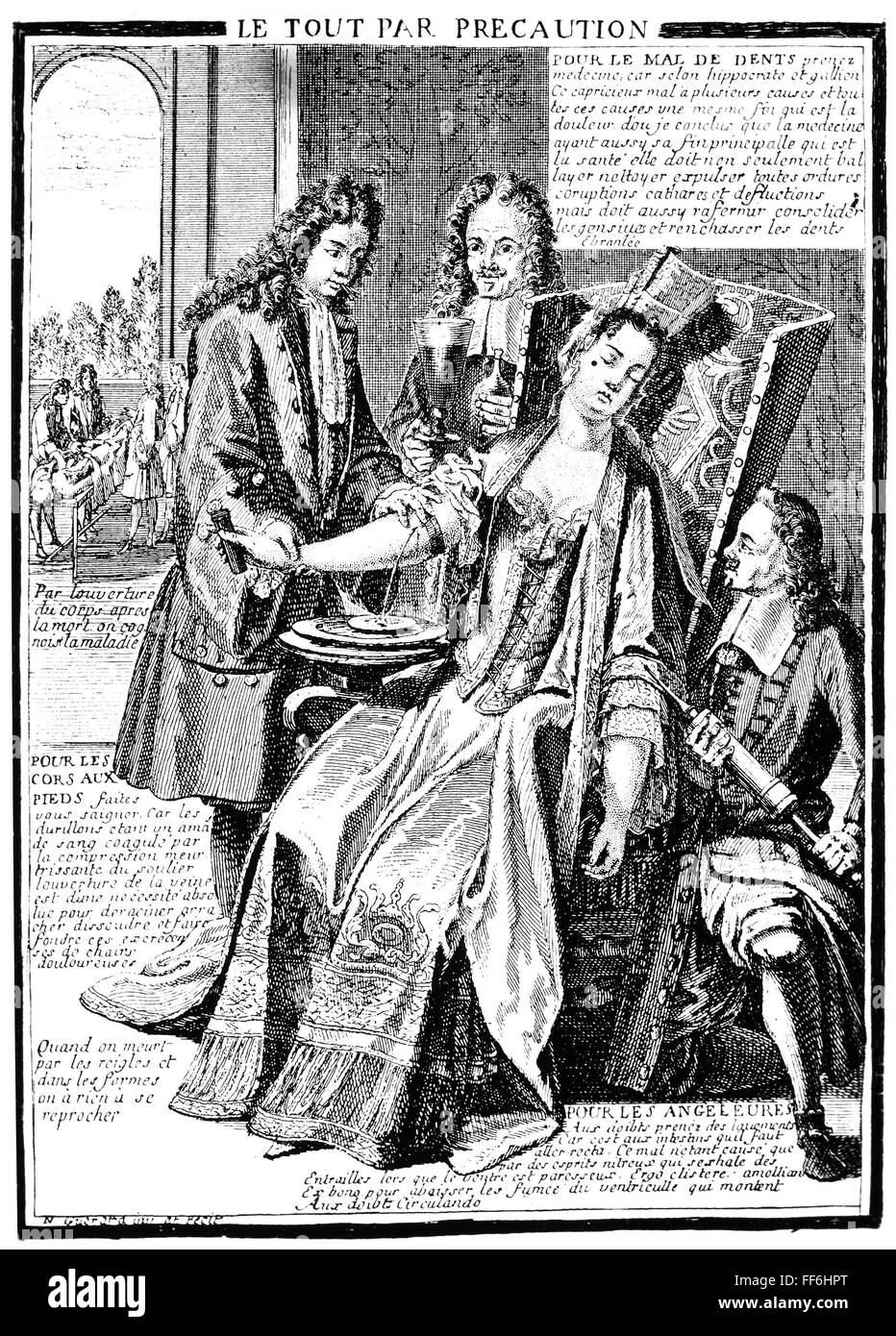 BLOODLETTING, 16th CENTURY. /nA Physician Practicing Venesection ...