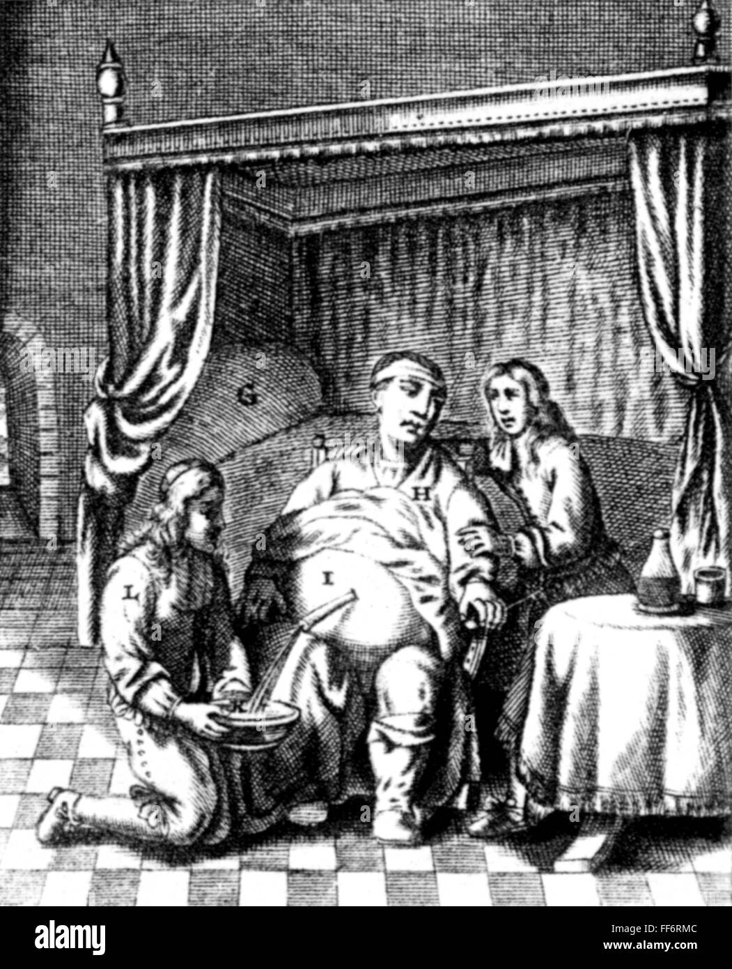 Disease dropsy hires stock photography and images Alamy