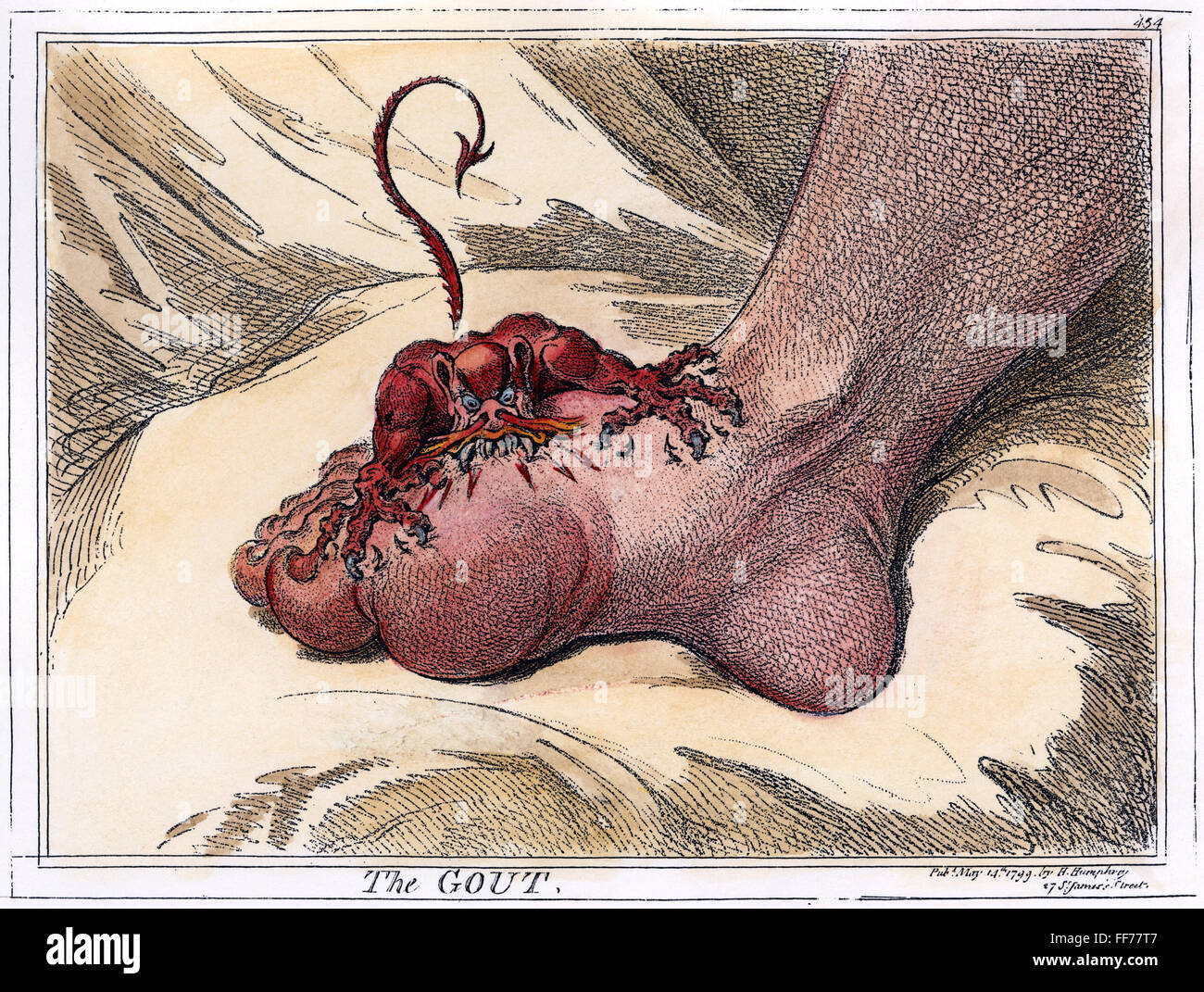GOUT, 1799. /n'The Gout.' Etching, 1799, by James Gillray. Stock Photo
