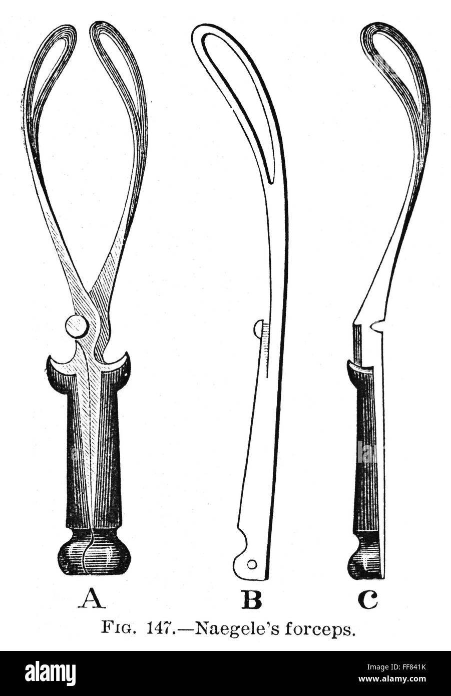 CHILDBIRTH FORCEPS, c1880. /nA diagram of Naegele's forceps, used in