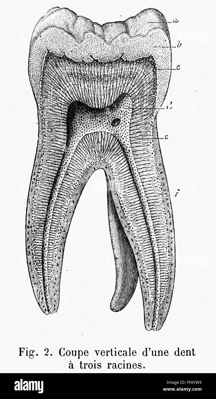 Three Roots Plate Shape TOOTH WITH THREE ROOTS. /nVertical section. Line engraving, French ...