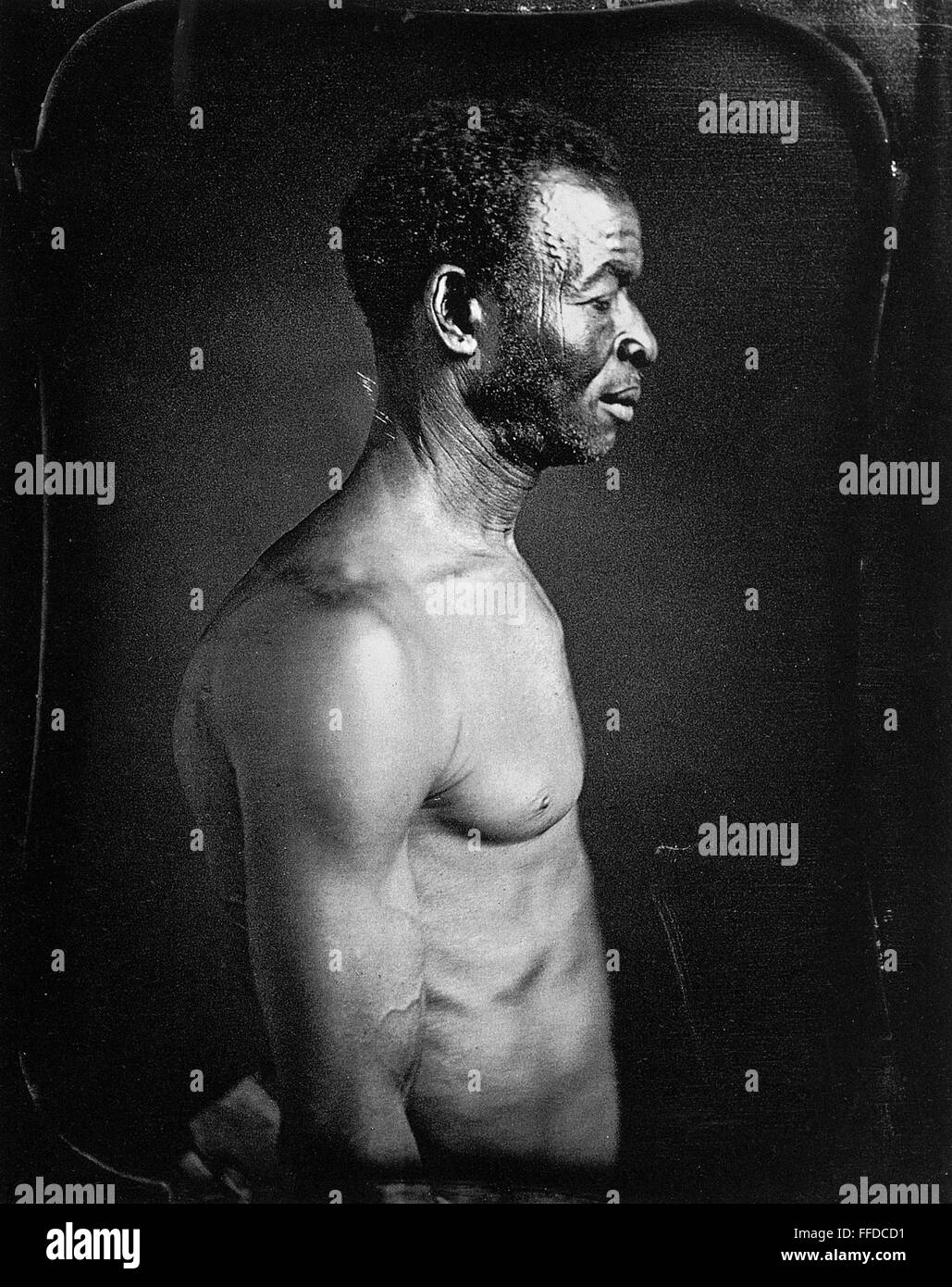 Scar plantation Black and White Stock Photos & Images Alamy