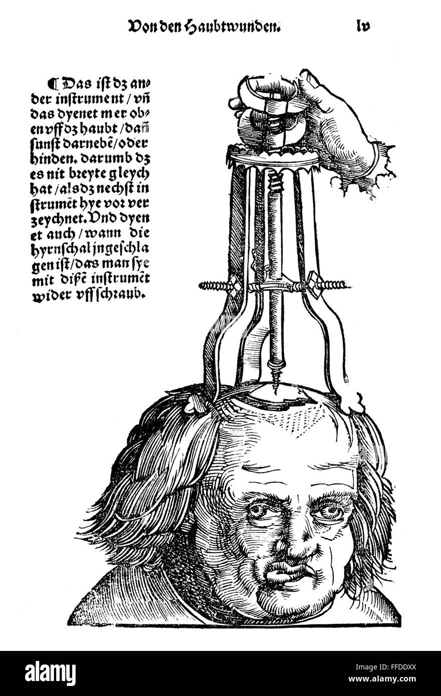SKULL OPERATION, 1517. /nThe extraction of a bone fragment from the brain resulting from a skull fracture. Woodcut from the first edition of Hans von Gersdorff's 'Feldtbuch der Wundartzney' (Guide to Surgery), Strassburg, 1517. Stock Photo