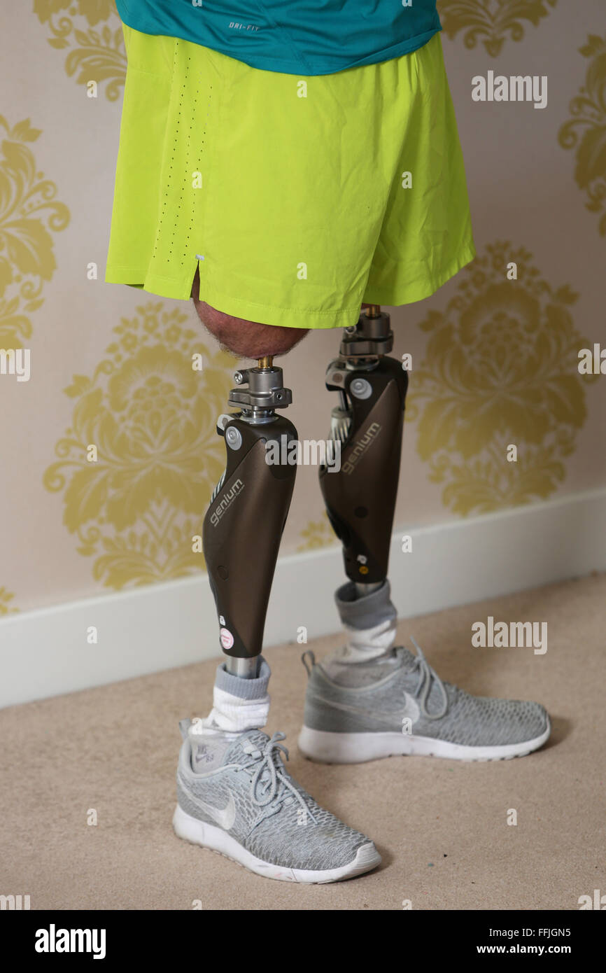 Male pictured with prosthetic legs in London, UK. Stock Photo