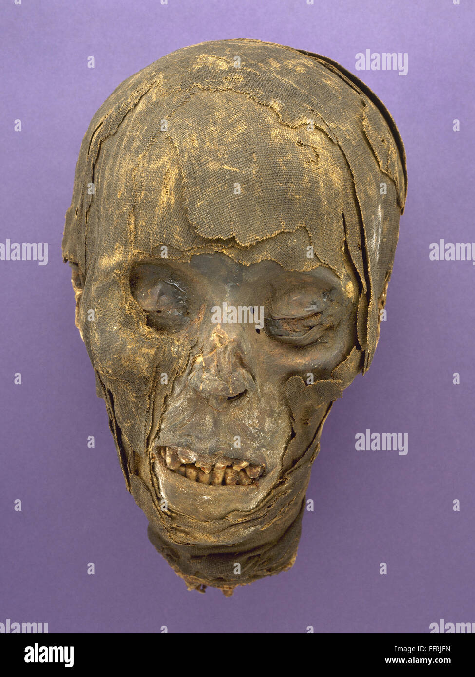 ANCIENT EGPYT: MUMMY. /nThe mummified head of an unidentified Egyptian. Stock Photo