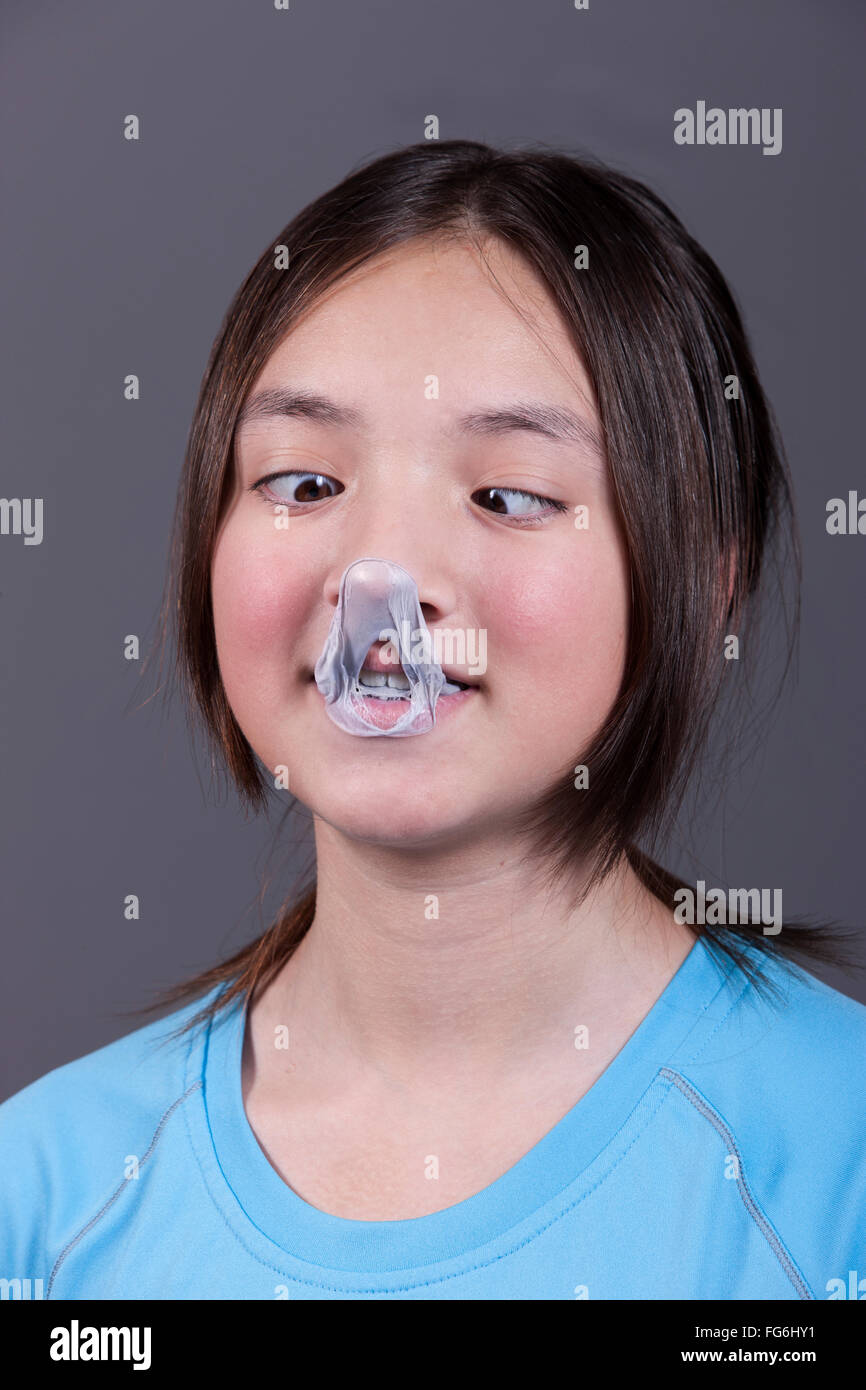 A girl has a cross eyed look as she looks at the popped gum mess on her nose. Stock Photo